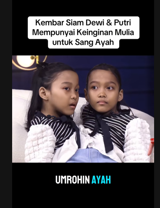 Kembar siam Dewi dan Putri ingin umrohkan ayah